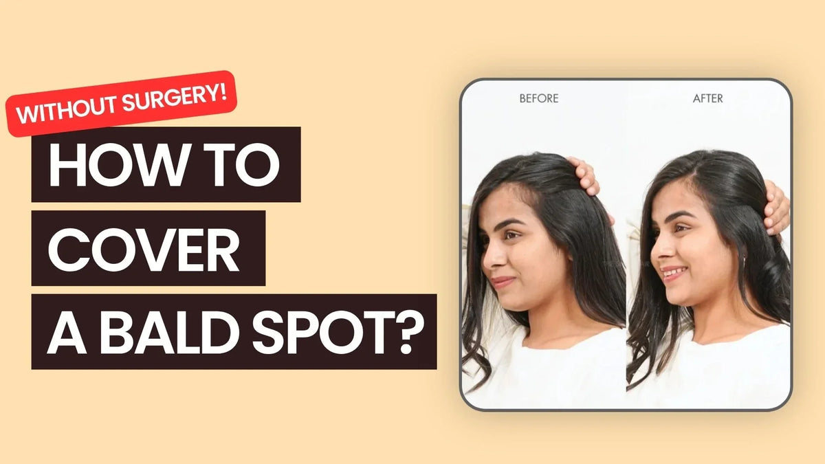 How to Cover a Bald Spot Instantly Without Surgery?