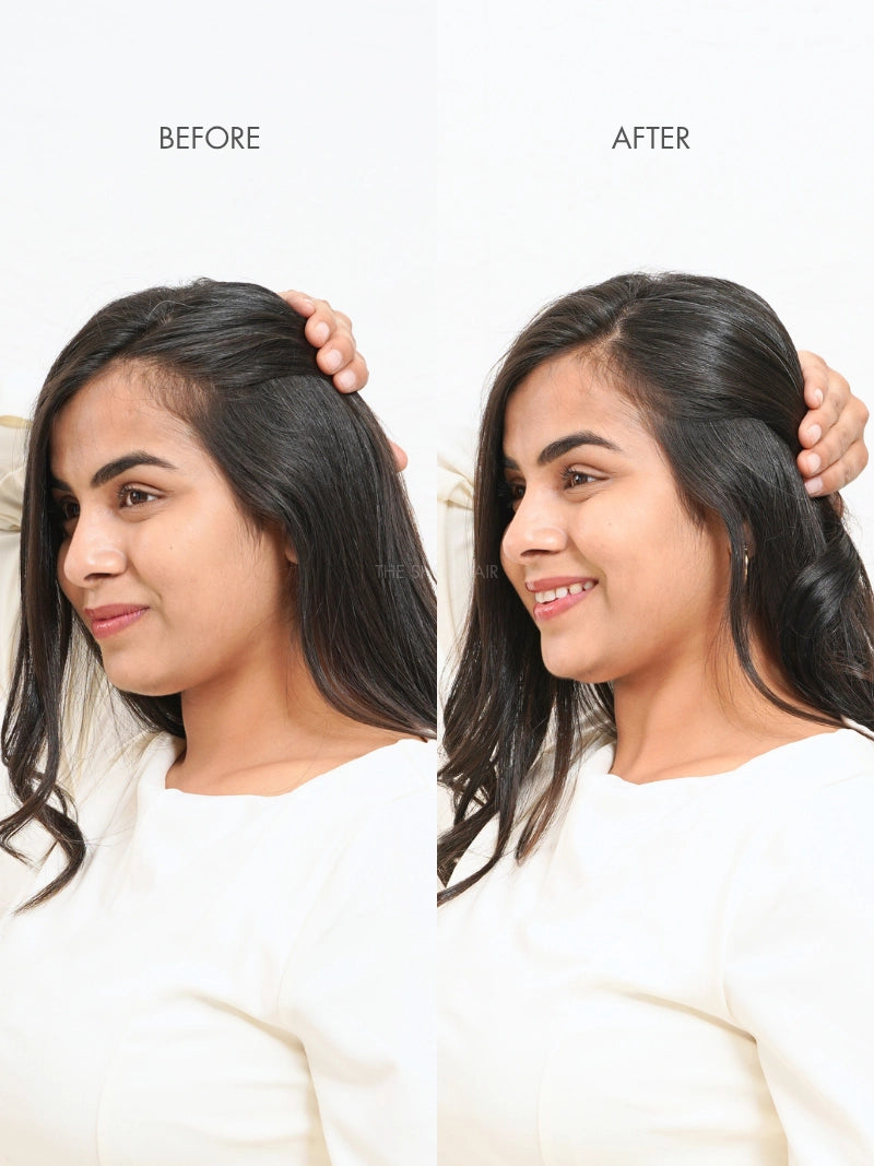 Buy hair originals hair extensions for women online, Buy 100% human hair extensions for ladies online, Buy 100% hair patches for women near me, Buy hair extensions for thinning on temple area