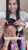 front-hairline-patch_08